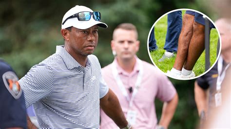 Tiger Woods sitting in a doctor's office discussing his injury