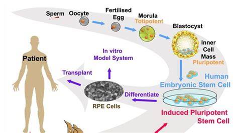 A laboratory setup showing the process of reprogramming somatic cells into iPSCs.